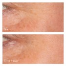 XBiotic Radiance Serum thumbnail